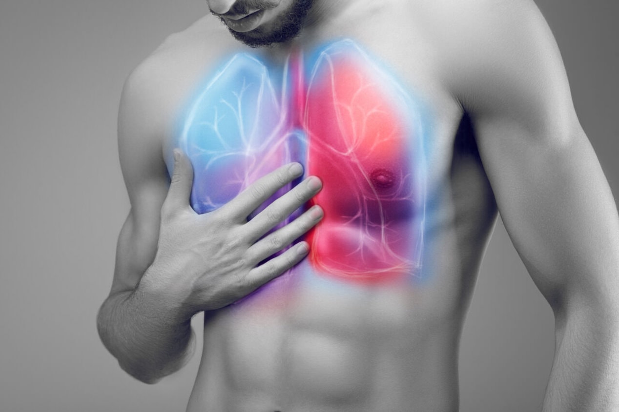 Darstellung der Lungenflügel, Schmerzen